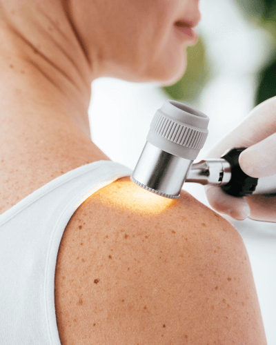 dermatologo-especialista-en-condiloma.png